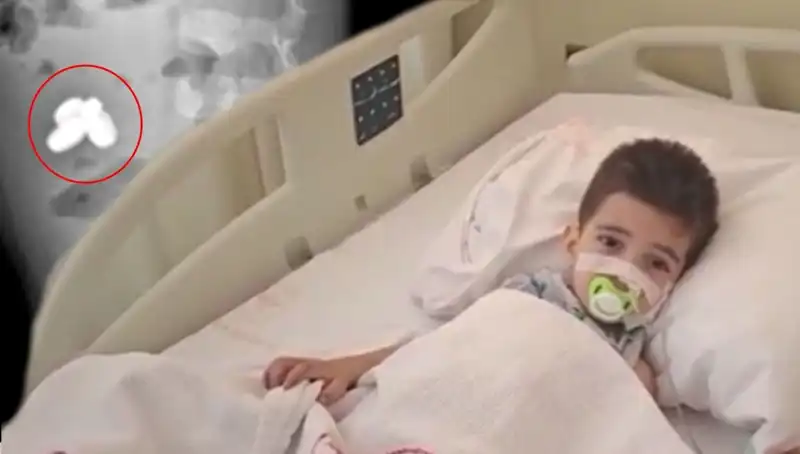 Küçük Çocuğun Hayatını Düşündüren Kaza: Pil ve Mıknatıs Yuttu