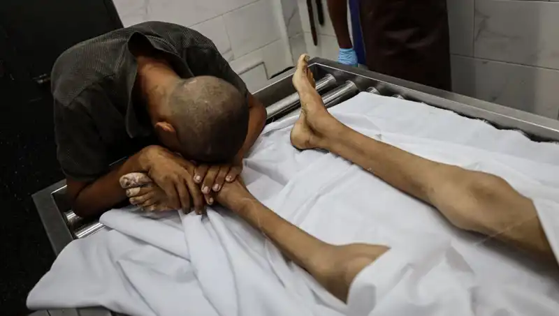 Gazze'de Bir Çocuk Daha Açlıktan Hayatını Kaybetti: Acı Gerçekler