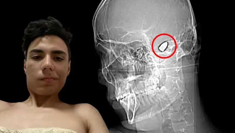 Kafasında Patlamaya Hazır Bomba İle Yaşamak: Bir Genç Kadının Mücadelesi